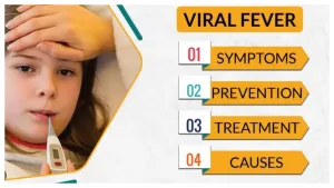 viral fevers